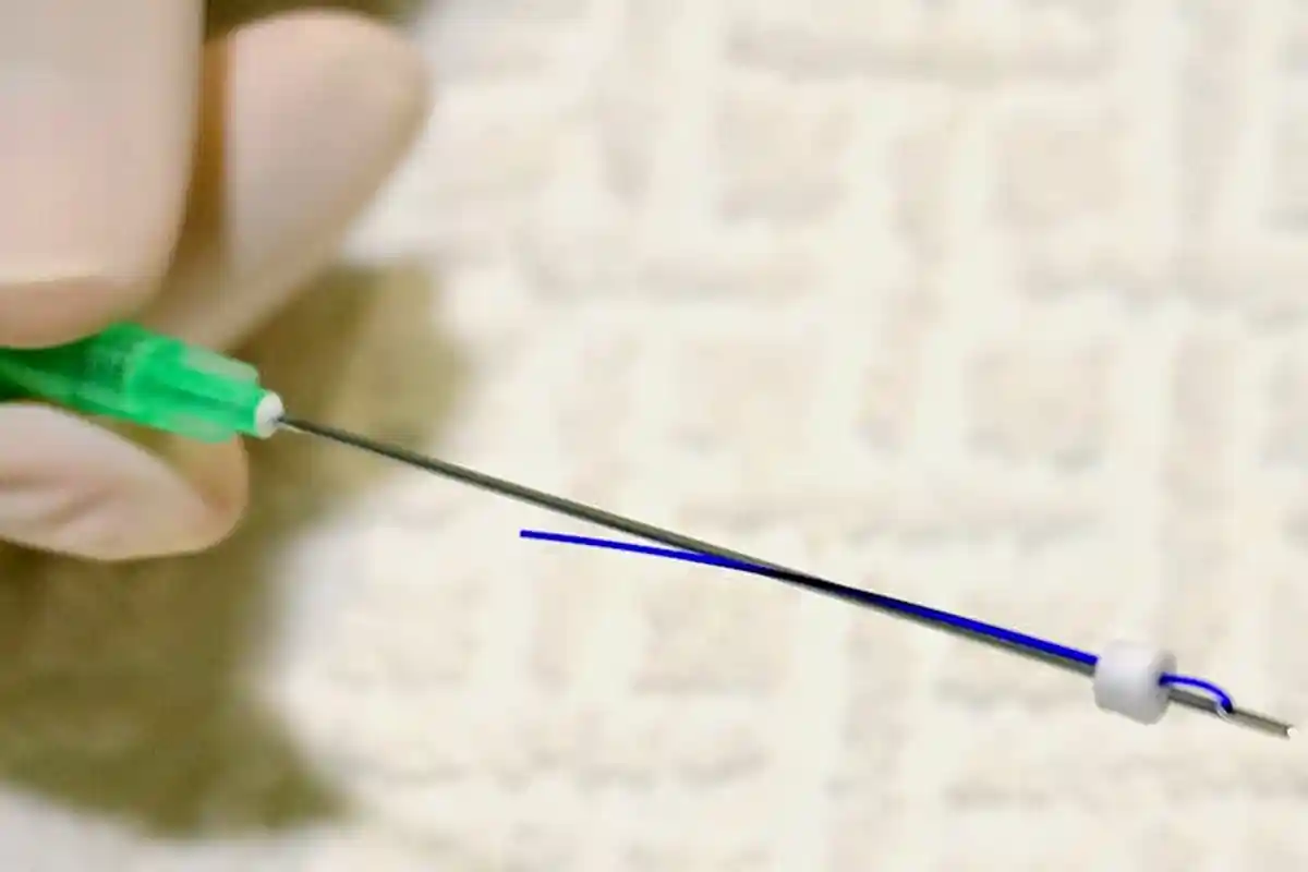 Alih-alih Menjadi Cantik, Operasi Filler dan Tanam Benang Bisa Berujung Kematian