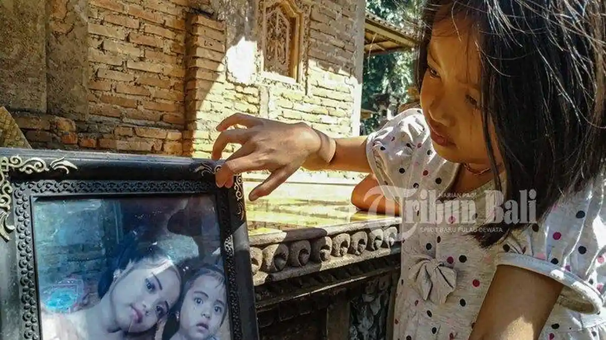 Bocah Cantik di Klungkung Bali Muntah Darah Jika Tak Minum Obat