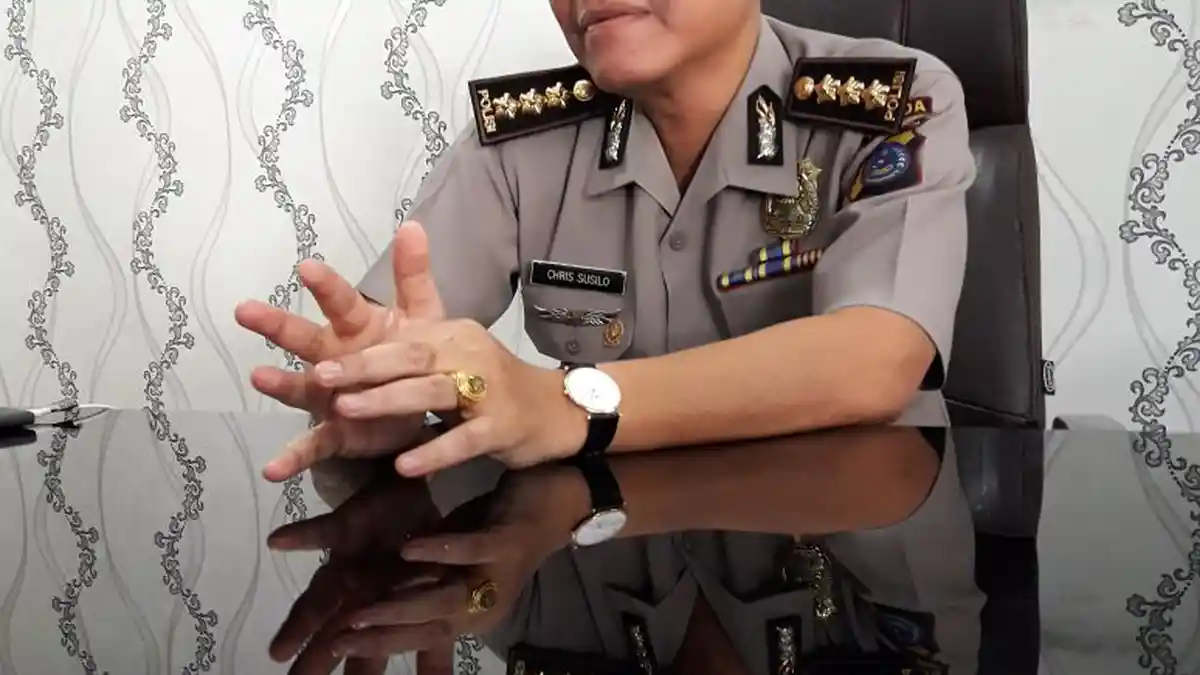 Ini Alasan Kenapa Casis Polisi yang Memiliki Varises Tidak Lulus Tes