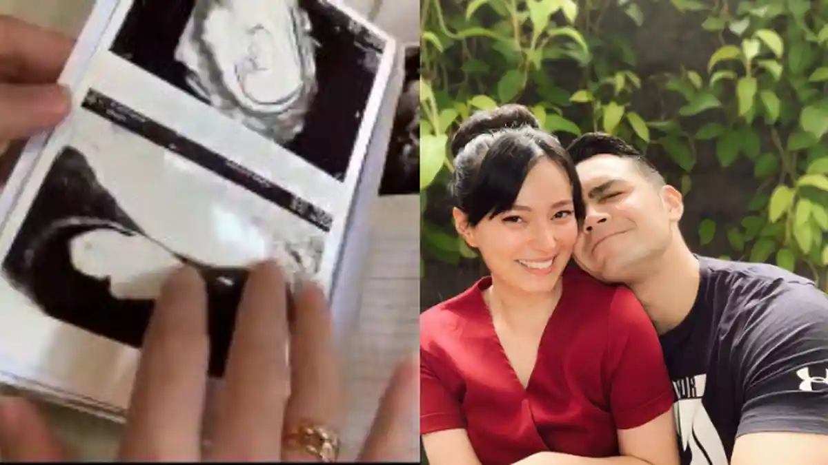 RAHIM Asmirandah Tak Bermasalah, Mengapa Program Bayi Tabung? Istri Jonas Rivanno Jawab Teka-teki