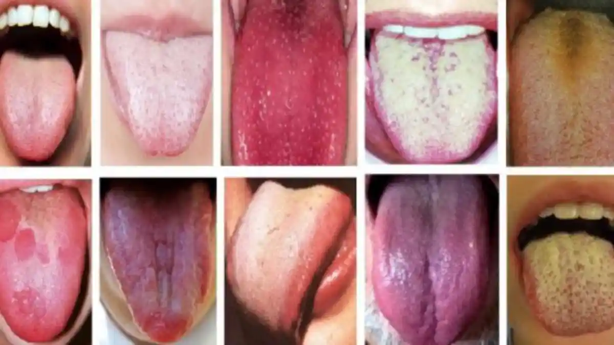 Gadis Cantik Ini Punya Lidah Panjang 5 Centimer dari Dagu, Mampu Dibengkokkan  Saat Lidah Dijulurkan