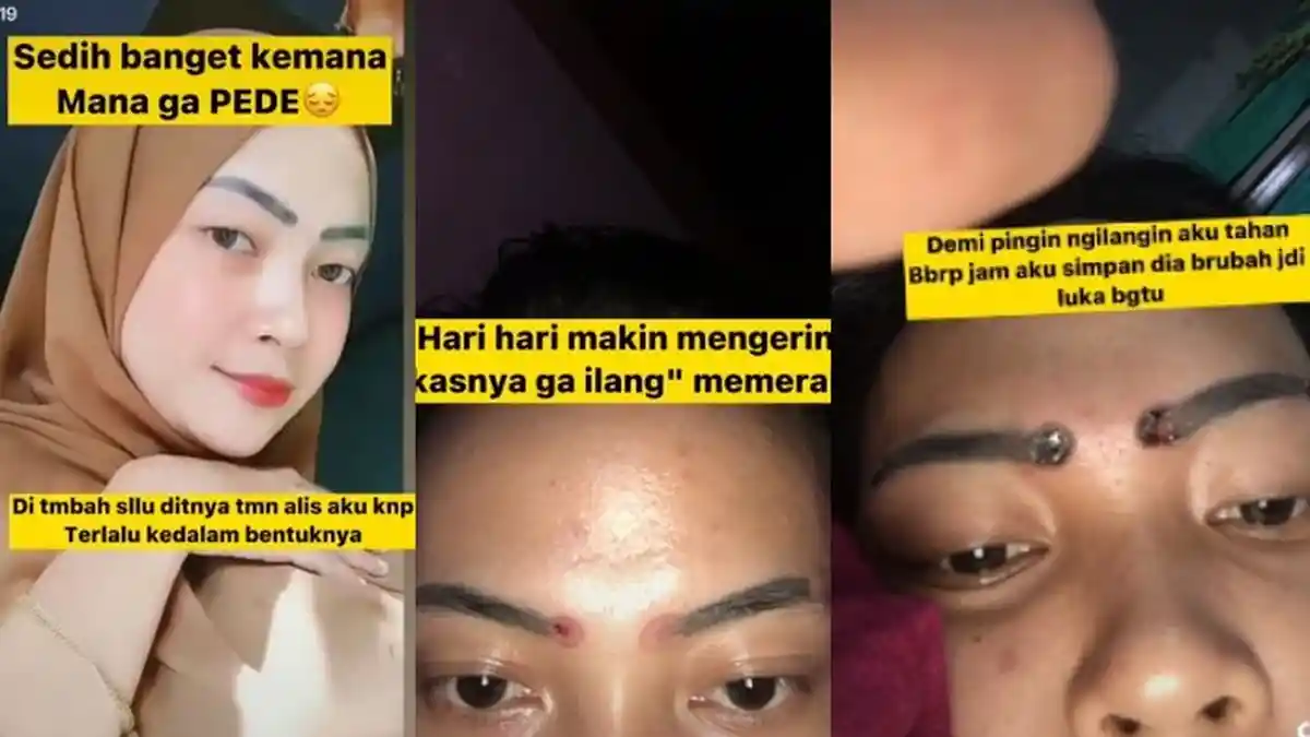 Viral Kisah Seorang Wanita yang Ingin Tampil Cantik, Putuskan Sulam Alis Tapi Berujung Tragis