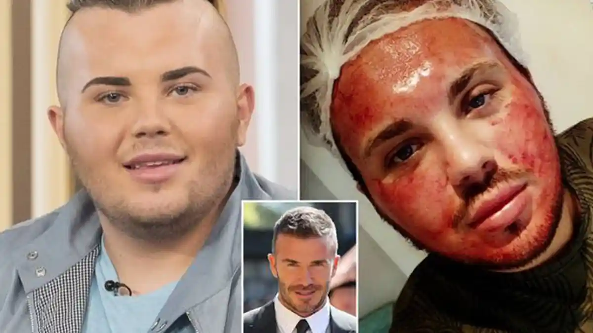 Terobsesi pada David Beckham, Pengangguran ini Habiskan Uang Rp 370 Juta untuk Oplas Mirip Brooklyn