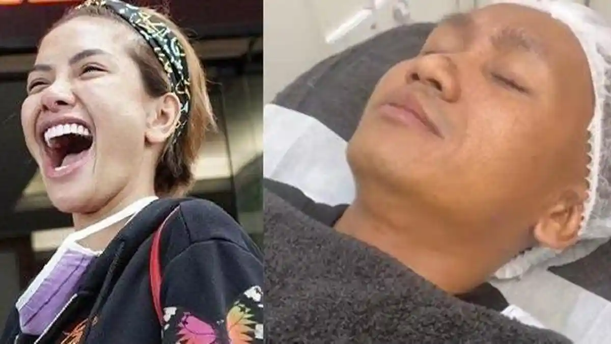 Balas Nikita Mirzani Usai Dihina Jelek, Pegi Setiawan Perawatan Wajah dan Pamer Banyak Tawaran Kerja