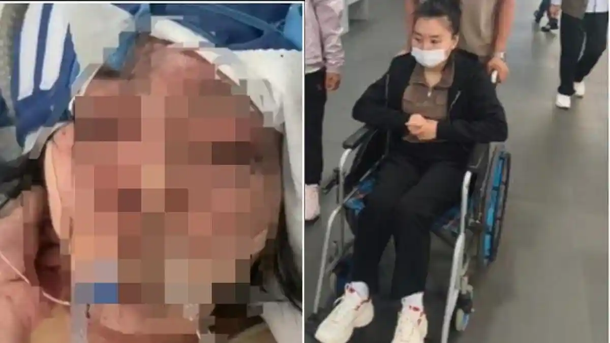 Nasib Pengantin Baru Koma 3 Bulan usai Dihajar Suami karena Game, Orangtua Hancur Lihat Anaknya Buta