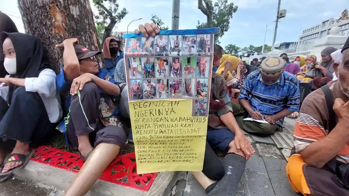 Puluhan Penderita Kusta Gelar Aksi di Depan Kantor Gubernur, Ini Tuntutan Mereka