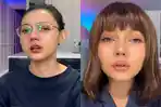 Rina Nose Akui Operasi Hidung, Beberkan Alasan di Baliknya