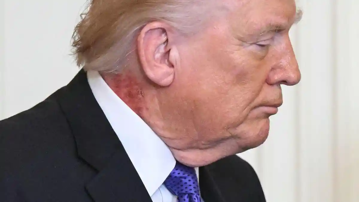 Suara Tembakan Warnai Jamuan Makan Malam Gedung Putih, Trump dan Istrinya Berhasil Diselamatkan
