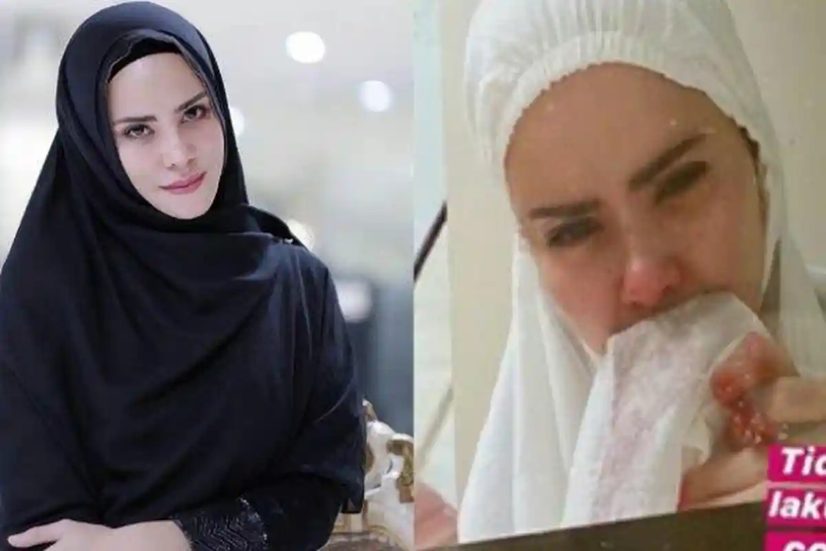 Angel Lelga Ungkap Trauma Berat Lihat Orang Lari-lari hingga Kerap Perhatikan CCTV Rumah