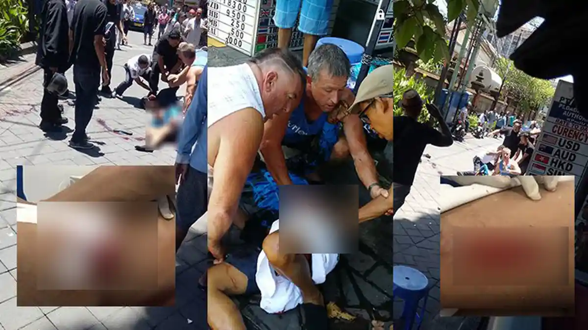 Permainan Kartu Remi Berujung Duel, Tubuh Ketut Ngarta Bersimbah Darah