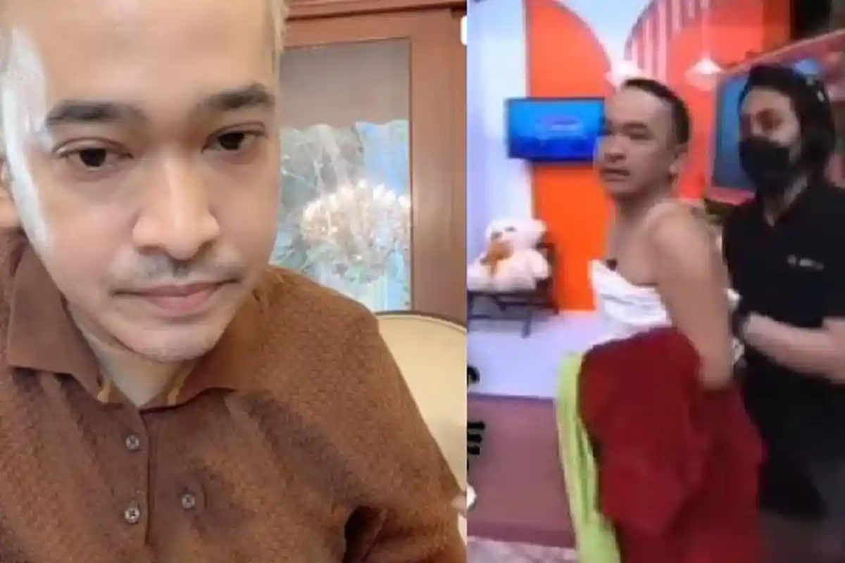 Pengakuan Ruben Onsu Didorong Kru TV Sampai Nyungsep Kesakitan, Gak Mau Bohong: Semua Juga Lihat