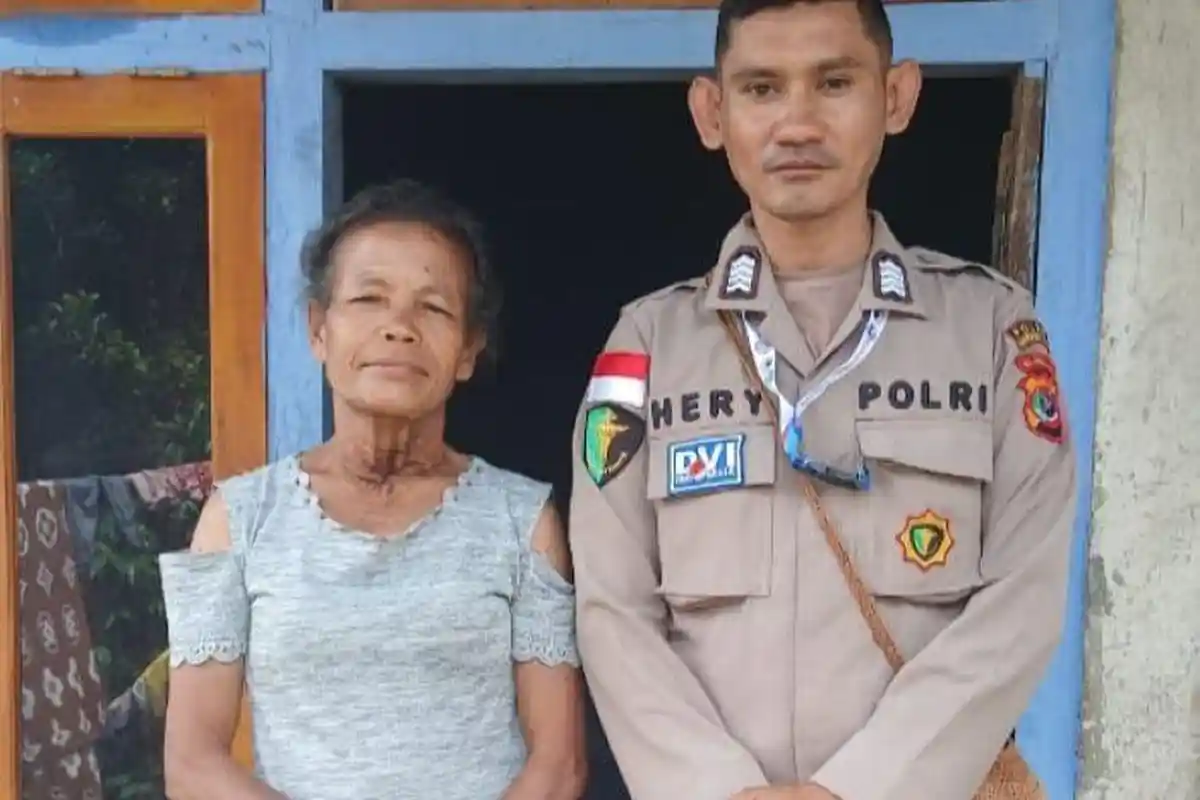 Kerja Sama Polres Manggarai Timur dan YHFM, Penderita Gondok Berhasil Dioperasi Berkat