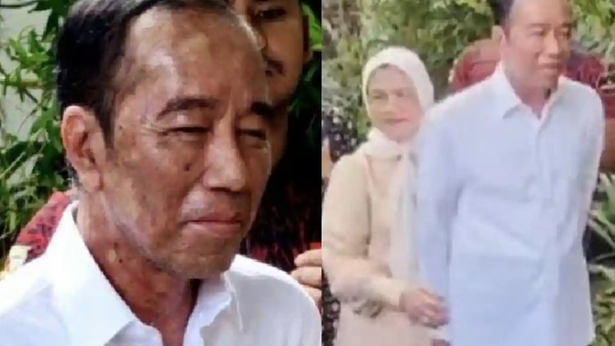 Perubahan Wajah Jokowi di Hari Ulang Tahun, Penuh Bercak Putih, dr Tifa Soroti Perut