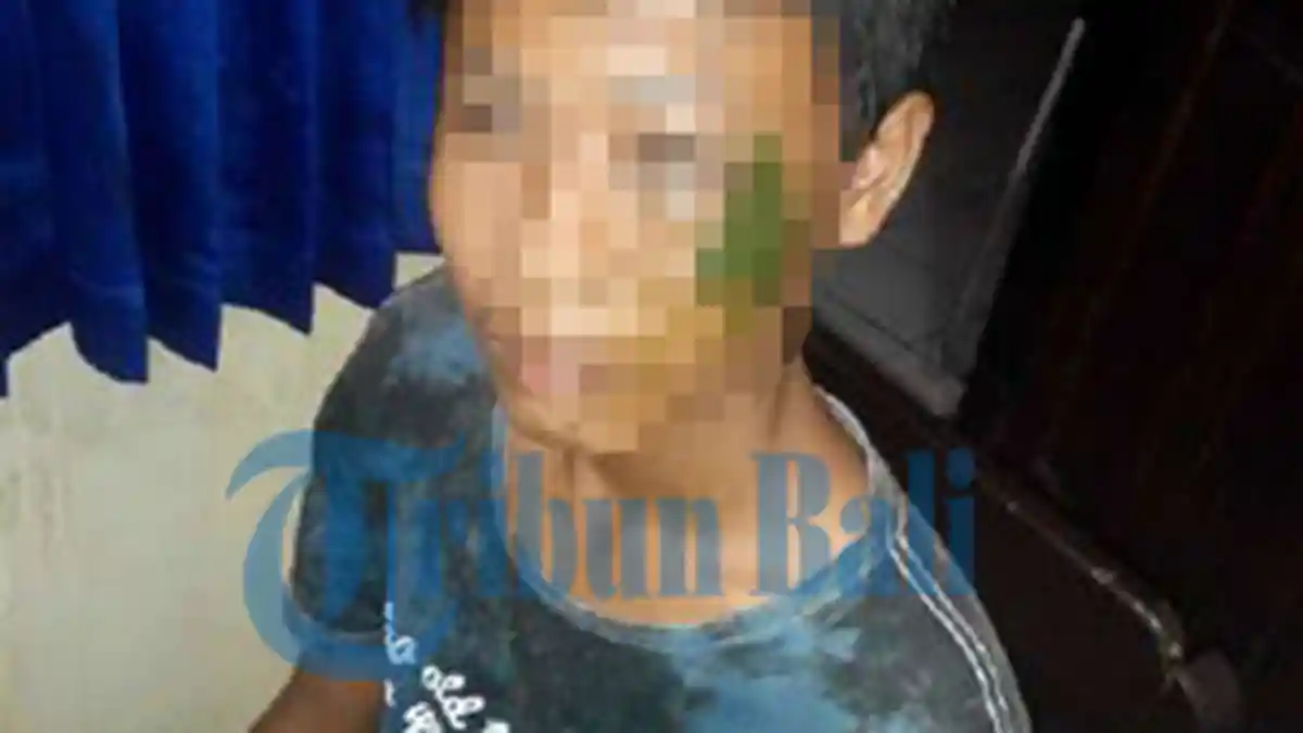 Duel Pelajar SMP Vs SMA di Jembrana Tinggalkan Sayatan di Paha