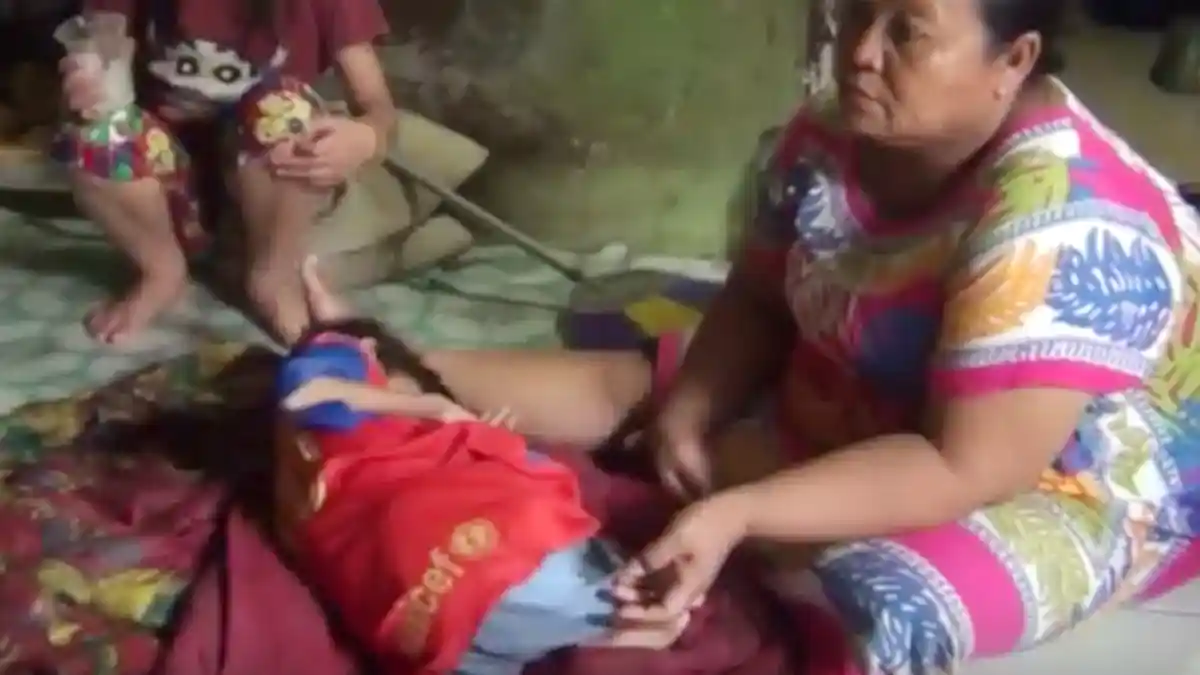 Desa Harus Membantu Anak Gizi Buruk