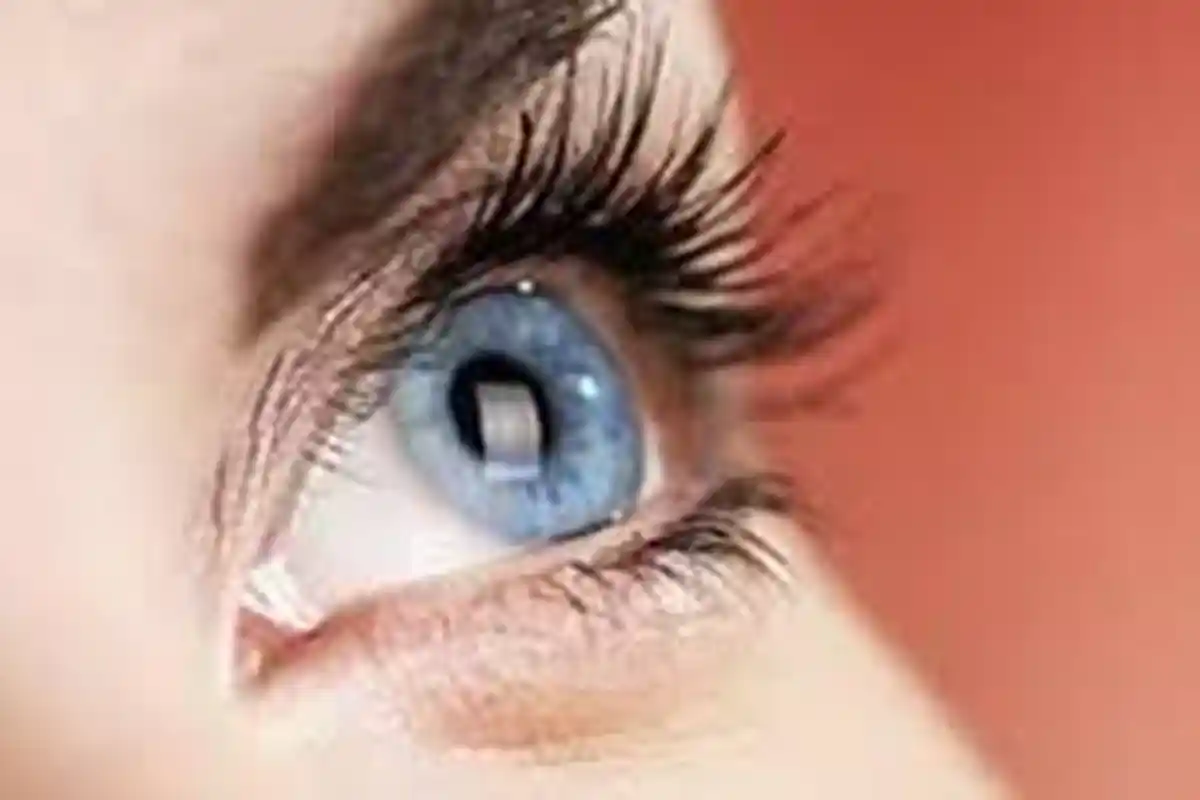 Di Bagian Hitam Mata Ada Warna Putih, Gejala Katarak?