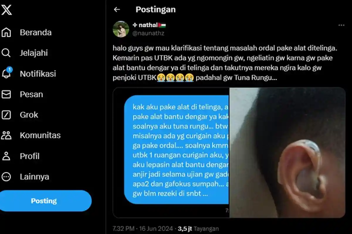 Viral Tuna Rungu Peserta UTBK Diminta Lepas Alat Bantu Dengar saat Ujian SNBT, Dicurigai Joki