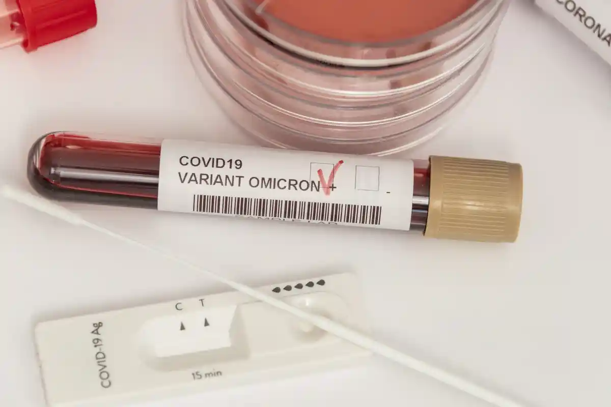 Tips Sehat, Tenang Hadapi Omicron, Jika Terpapar, Konsumsi Vitamin Ini, Simak Daftarnya