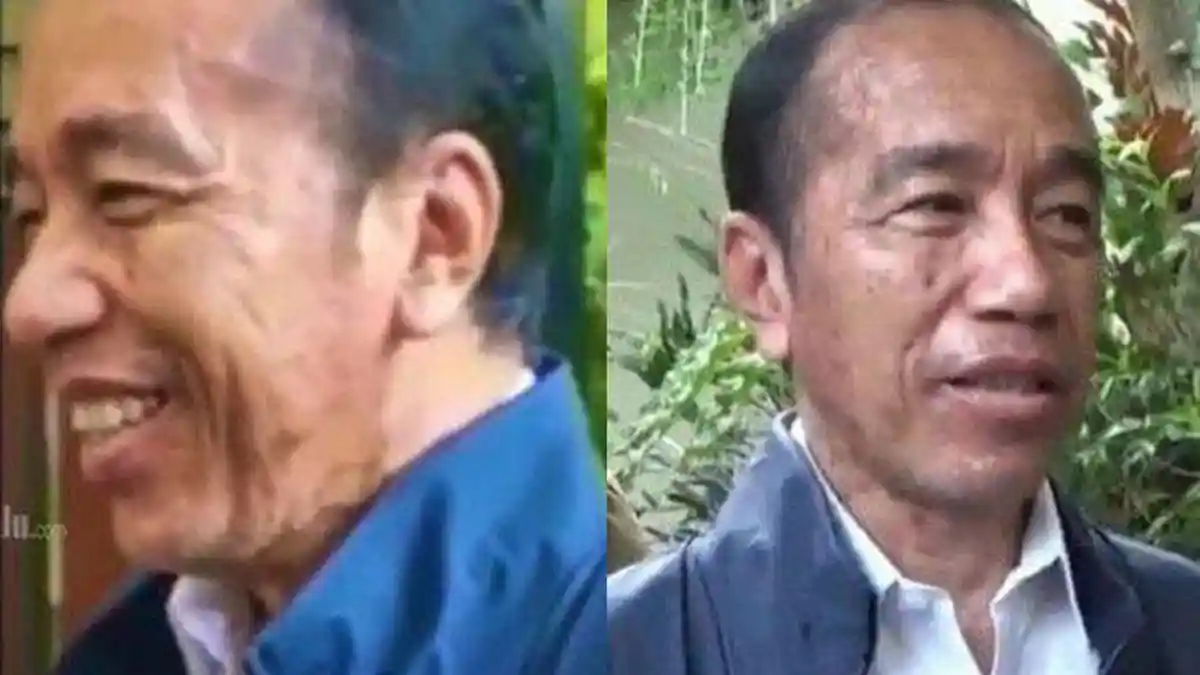 Penyakit Sebenarnya Jokowi hingga Wajahnya Berubah Drastis, Ajudan Buka Suara, Singgung Pemulihan