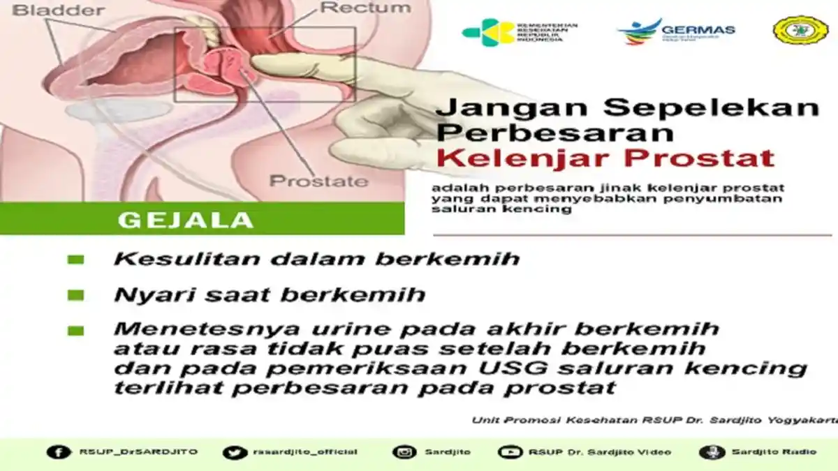 Kena Prostat di Usia Muda, Gejala Penyakitnya Rasa Sakit atau Panas Saat Kencing Urine Bau Tak Sedap