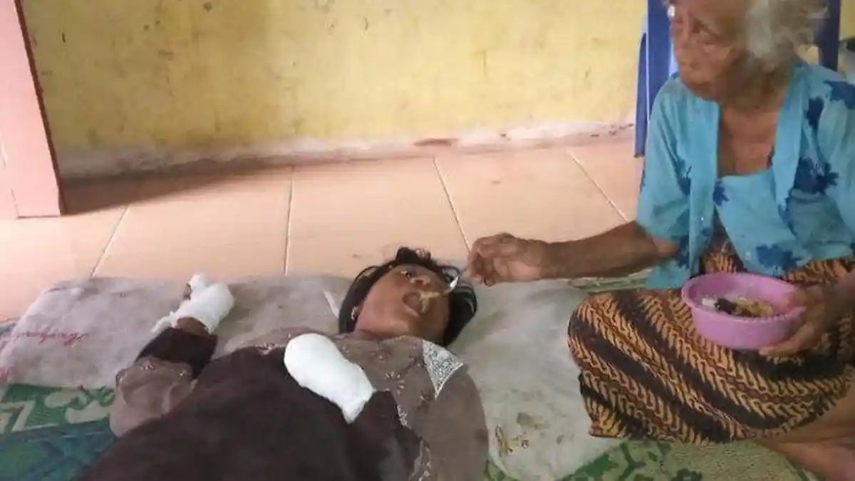 Wanita Gangguan Jiwa Ini Gigit Jarinya Hingga Putus
