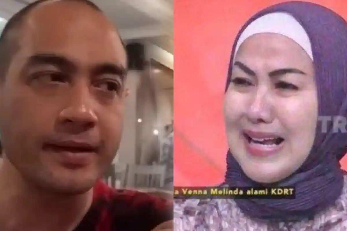 Tangis Venna Melinda Pecah, Dianggap Hanya Akting di Kasus KDRT hingga Dituding Pukuli Diri Sendiri