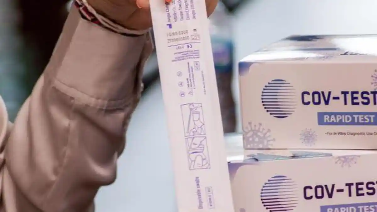 Pemerintah Bersiap Lakukan Testing dan Tracing Masif Dalam Waktu Dekat