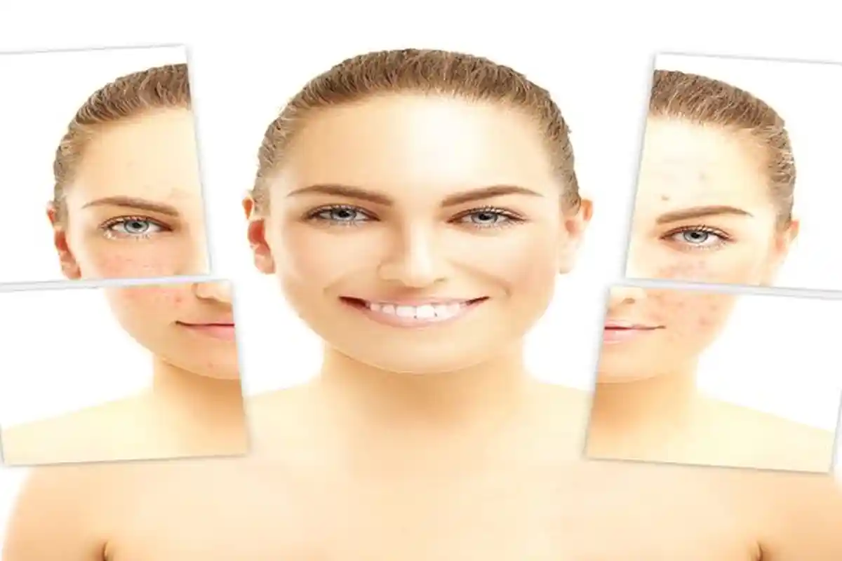 Pengen Punya Kulit Wajah Cerah, Cukup Pakai Bahan Alami Garam dan Mentimun, Begini Caranya