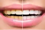 Kesehatan-gigi.jpg