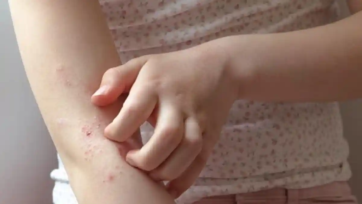 6 ARTI Mimpi Alergi, Anak terkena alergi, Tanda Kurangnya Rasa Perhatian dalam Keluarga