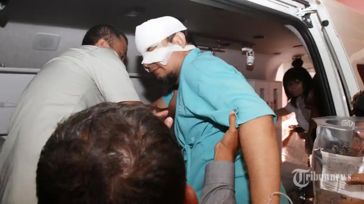 Novel Baswedan Tak Boleh Kena Air Selama Sebulan