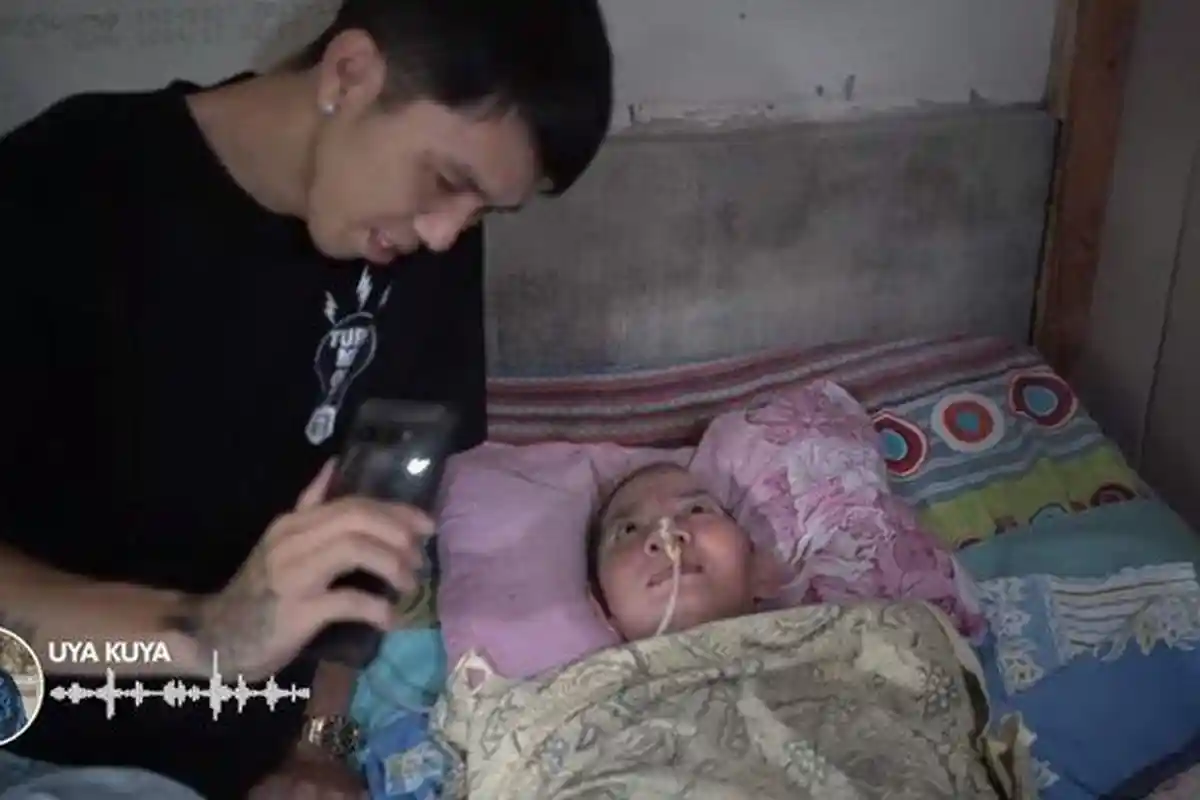 Nasib TKW Sulis 8 Tahun Tak Bisa Duduk Sepulang dari Taiwan, Pilu Kepala Penyok, Kini Butuh Bantuan