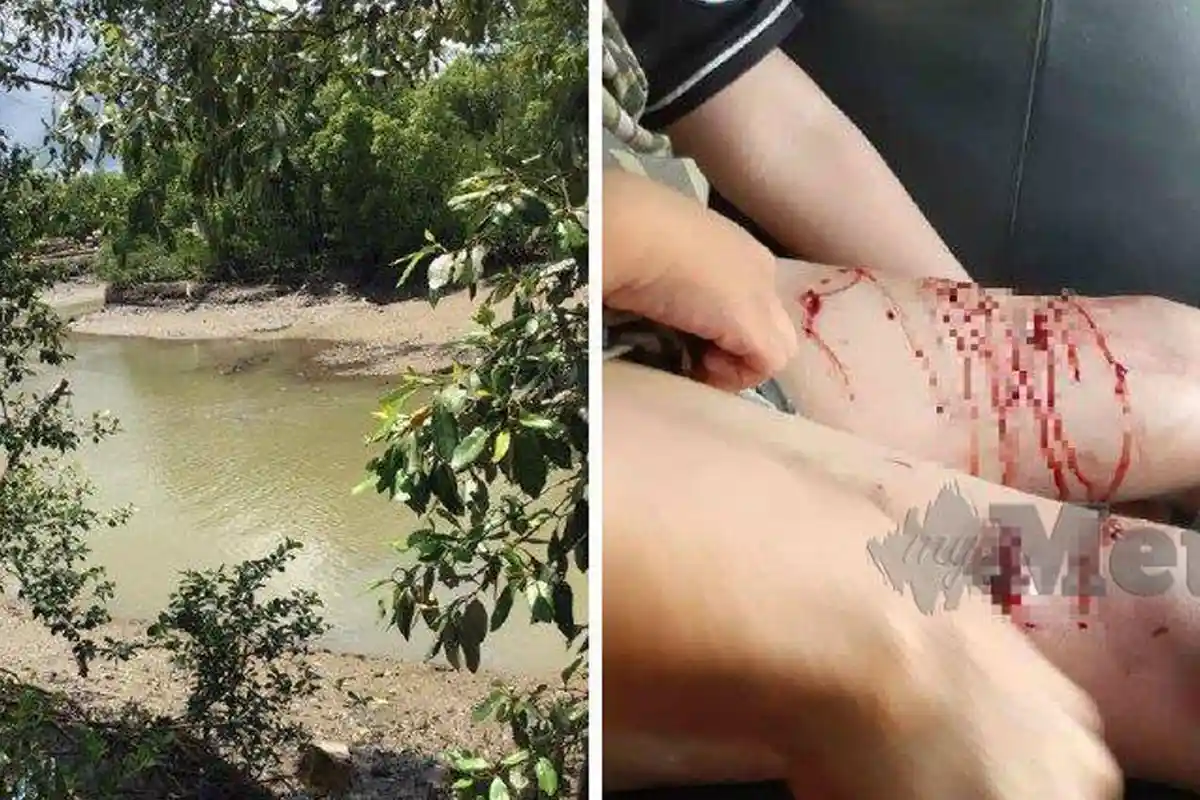 Bocah 14 Tahun Diterkam Buaya di Leher dan Pinggang, 2 Teman Bawa Korban ke Darat Naik Perahu