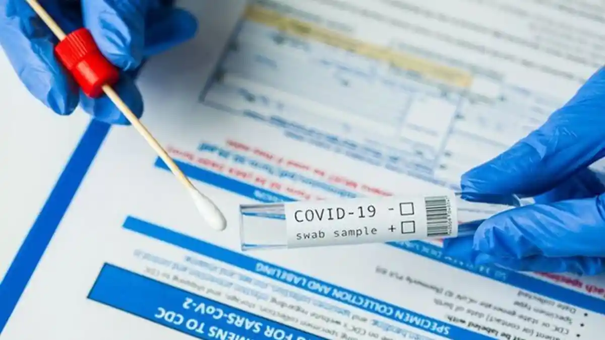 3 Hari Rapid Tes Antigen Massal di Halaman Kantor Bupati Manggarai Barat, 53 Orang Terpapar Corona