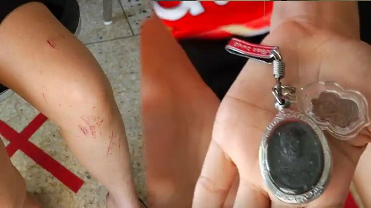 Baru Wisuda, Gadis Kecelakaan Bus, Selamat di Antara 14 Mayat, Dengar Teriakan Minta Tolong: Trauma