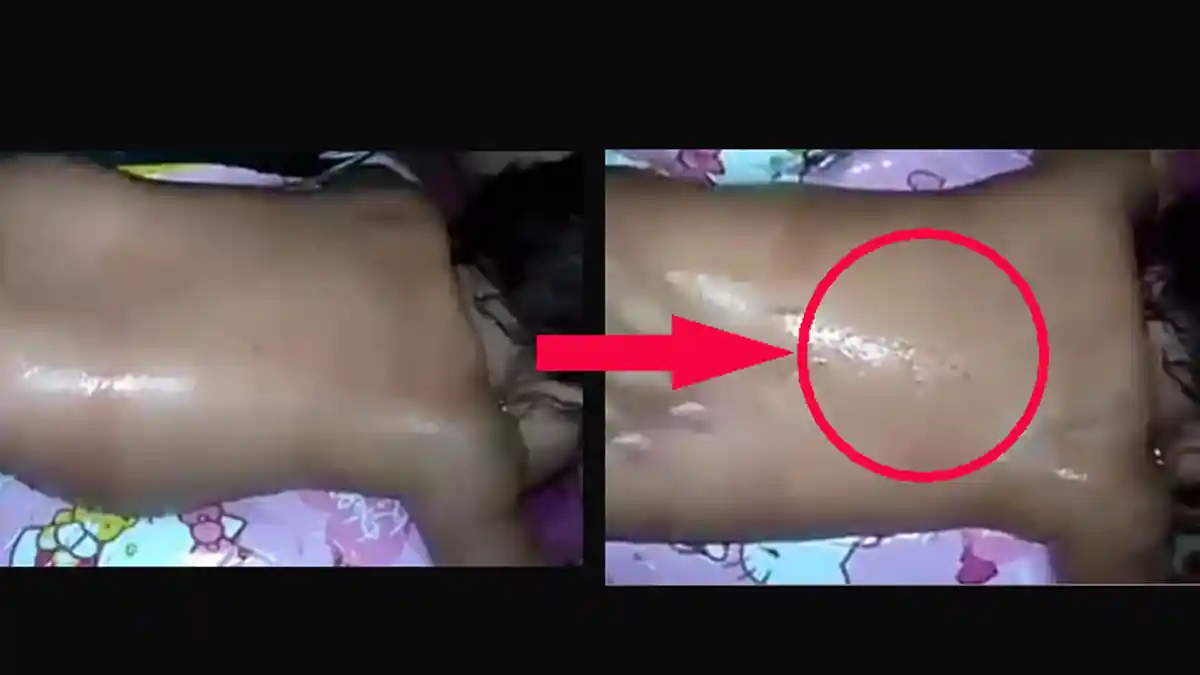 2 Hari Bayi Ini Menangis, Setelah Diperiksa, Ternyata Tubuhnya Mengeluarkan Benda yang Mengerikan