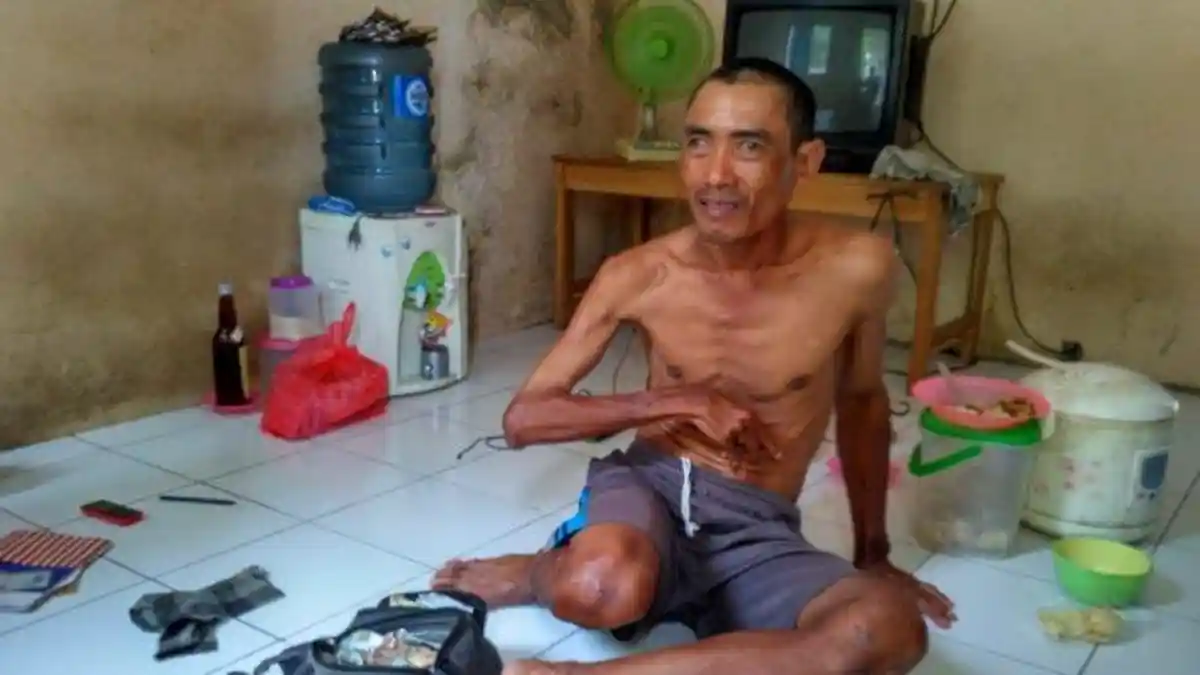 Cerita Lain Pengemis Legiman yang Punya Rp 1 Miliar, Sang Adik Ungkap Fakta Sebenarnya