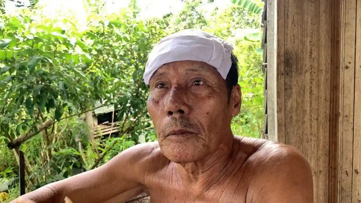 Saat Kebakaran, Ingin Selamatkan Motor Pemilik Rumah Yang Alami Stroke Jidatnya Melepuh Dijilat Api