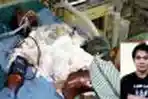 Sondang Hutagalung Dalam Perawatan RSCM 
