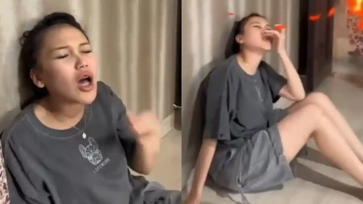 Curhat Ayu Ting Ting Kesakitan setelah Bibirnya Digigit sang Keponakan: Darah Gue Banyak Banget