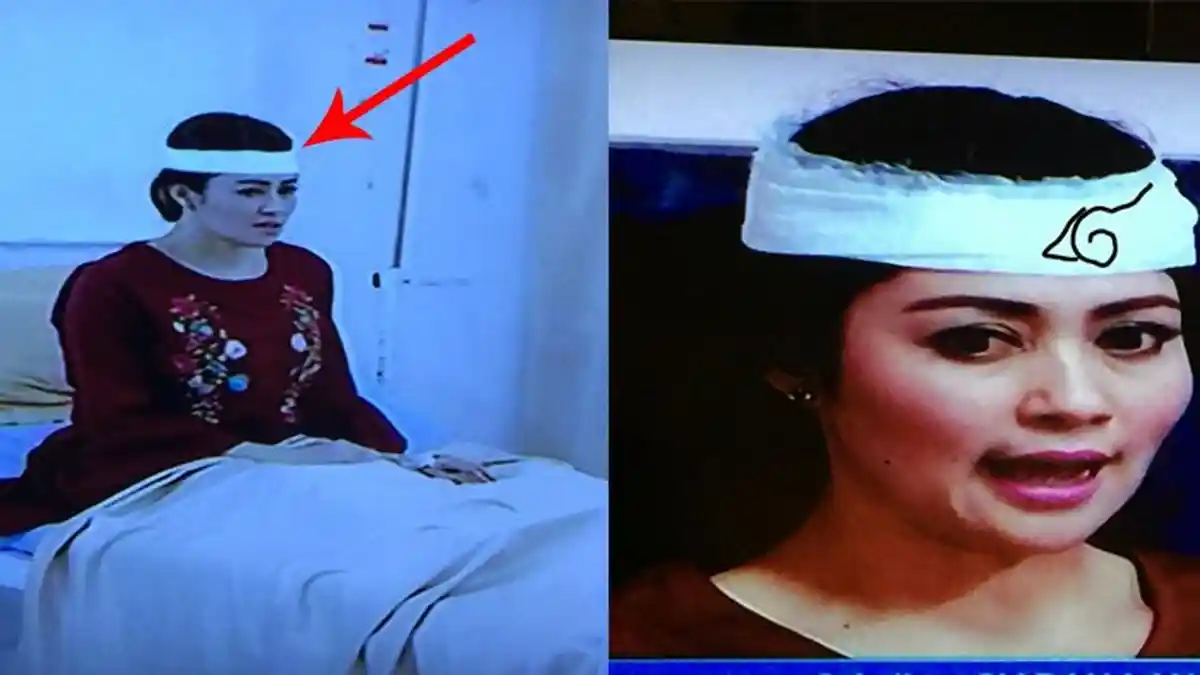 Balutan Perban di Kepala Jadi Khas di Sinetron-sinetron, Dokter Asli Aja Sampe Kebingungan