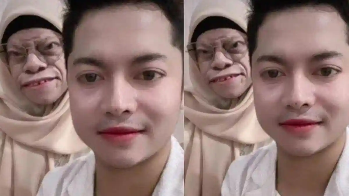 Sosok Artis yang Lamar Wanita Kelainan Gen, Calon Istri Abdul Rasyid Curhat Proses: Pantas Bersama