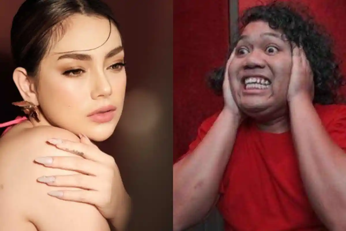 Perbedaan Wajah Celine Evangelista Disorot Setelah Didekati Marshel Widianto, Sahabat Protes Begini