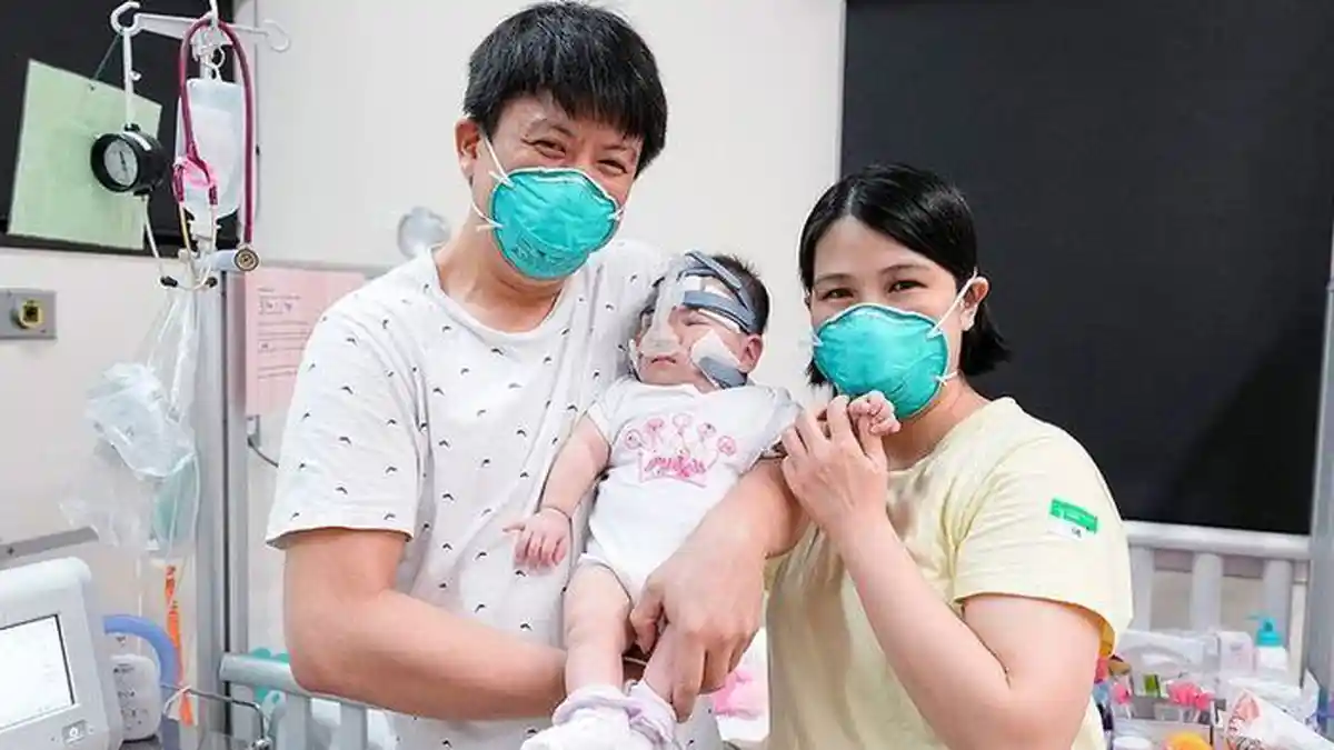 Bayi Terkecil di Dunia Lahir dengan Berat 212 Gram, Dirawat 13 Bulan di Rumah Sakit