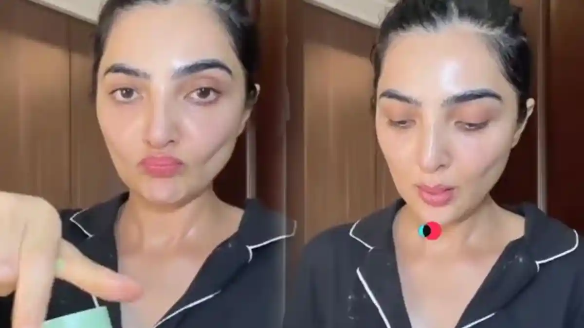 Disorot Kempot seperti Nenek Sihir & Diisukan Operasi, Ashanty Ungkap Kondisi Wajahnya Gegera Ini