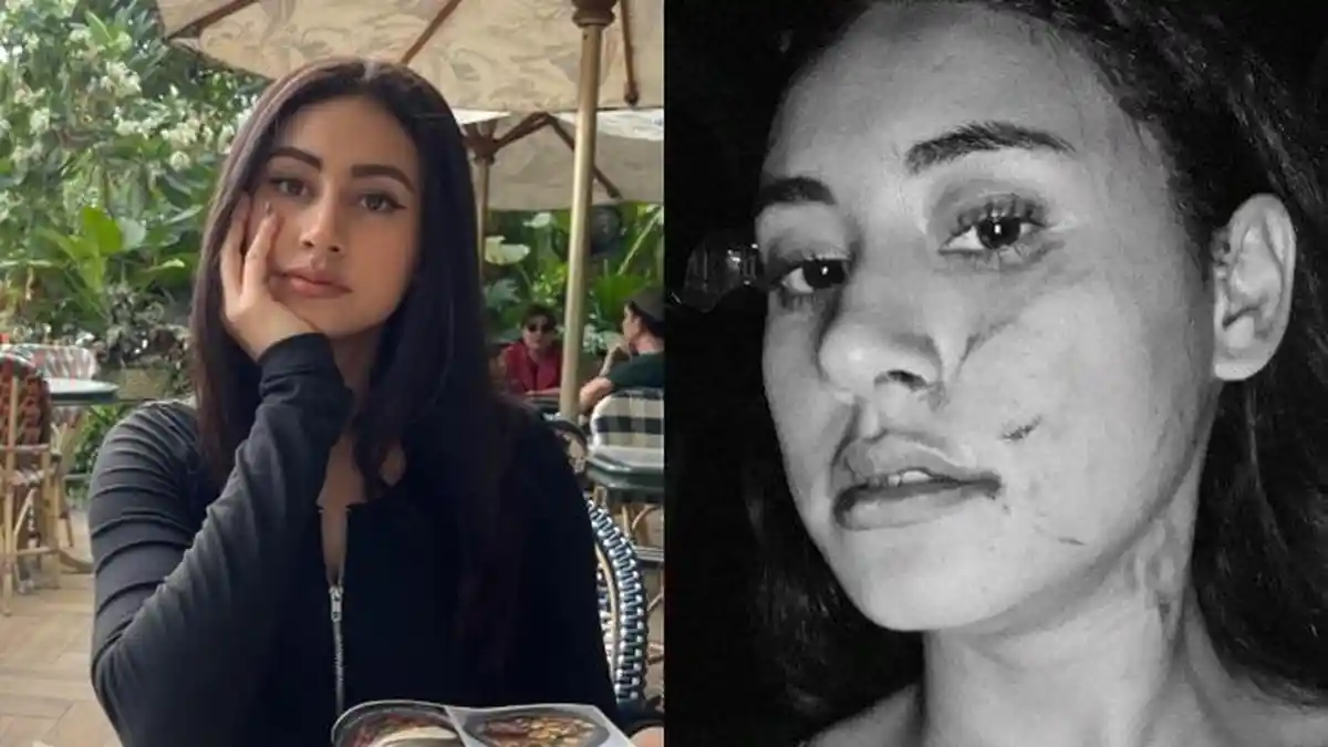 Sosok Afifah Riyad Selebgram Diduga Dianiaya Mantan Pacar Suami, Wajah Alami Babak Belur