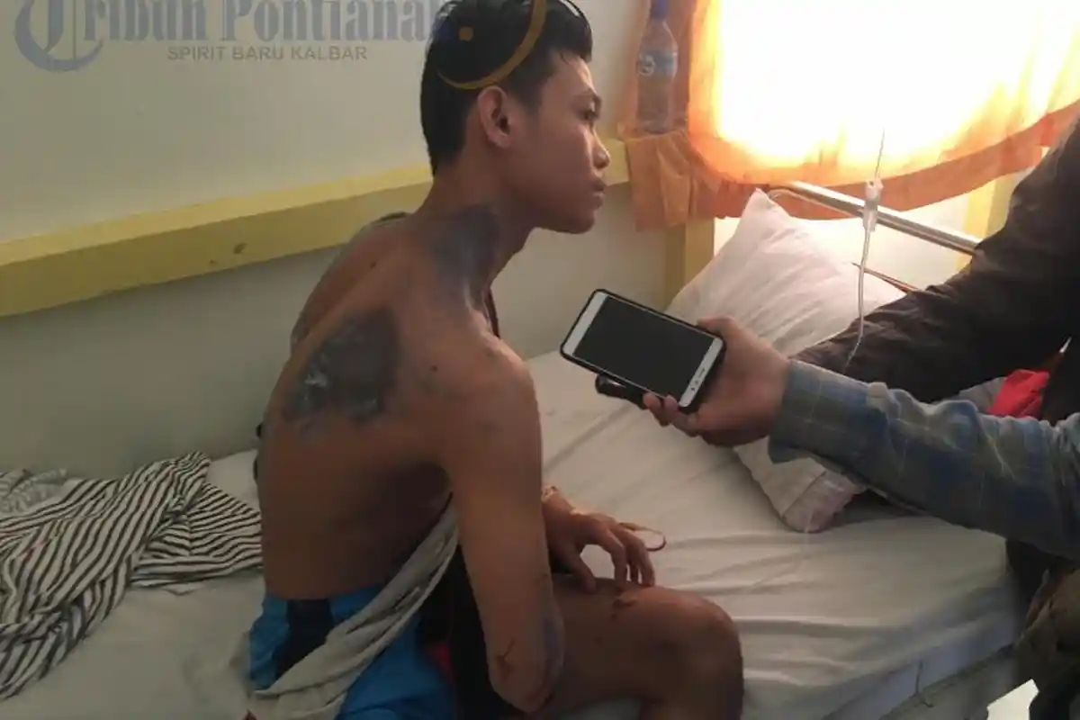 Foto-foto Dua Korban Penyiraman Air Keras, Begini Kondisi Mereka Saat ini! - damara-ramadhan-putra_20170504_225551.jpg