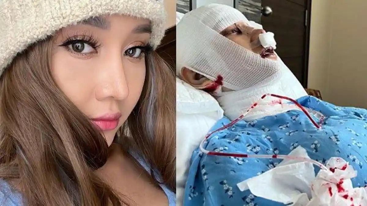 Lucinta Luna Demi Penampilan Rela Potong 4 Tulang Rusuknya