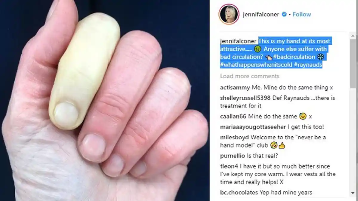 Presenter Ternama Ungkap Mengidap Suatu Penyakit Langka dengan Unggah Foto Ini