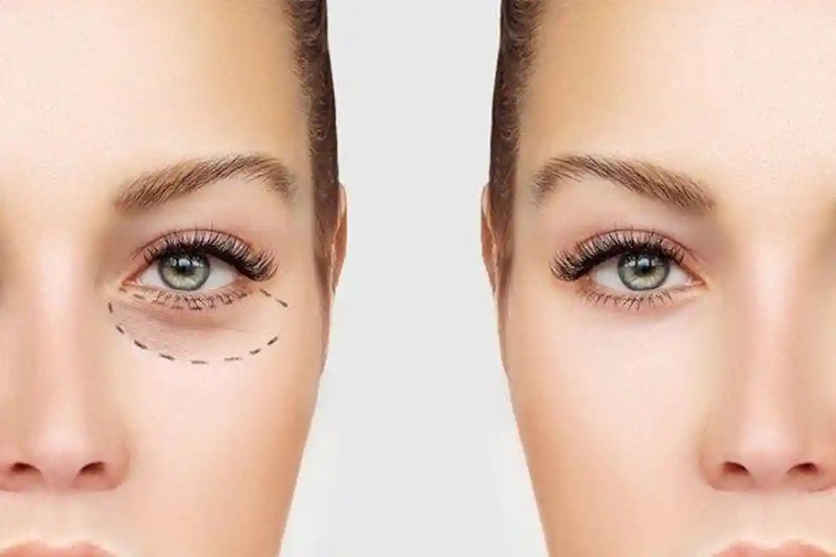 Sering Terpapar Cuaca Panas dan Polusi Udara, Ternyata Ini 5 Gangguan Mata dan Tips Mengatasinya